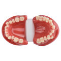 3D Resin Dental Model Teeth Malocclusion Model For Demostration Teaching Dental Students Study Oral Dentistry Products. 