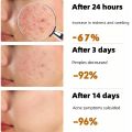 【Original】Men Face Cream Facial Whitening Cream Anti-Aging Moisturizer Anti Wrinkle Facial Skin Care Men Skin Tone 男士面霜面部美白120g. 
