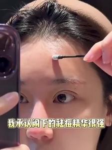 🌸正品现货🌸brlab小蓝瓶祛痘精华 Brlab Small Blue Bottle Acne Removal Essence Fast Salicylic Acid Facial Gentle Mark Repair Fade Men Women Cleansing Acne Removal 快速水杨酸面部温和印修复淡化