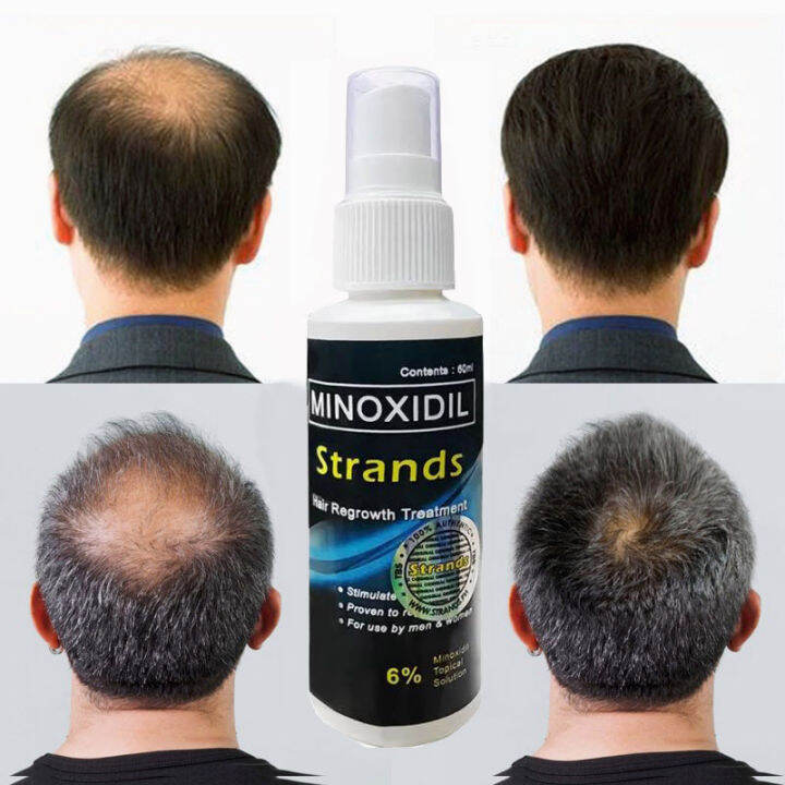 Original Minoxidil Strands 6% Minoxidil Premium Hair Grower Topical ...