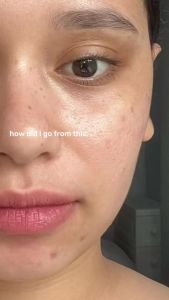 JellyPrim Vitamin C Moisturizer Serum for Face 3% Niacinamide Whitening Acne Scars Dark Spot Remover