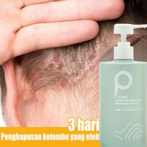 LIFUSHAShampo anti ketombe Shampo rambut rontok mite removal Shampo penumbuh rambut cepat Jahe ketombe / oil control 500ml