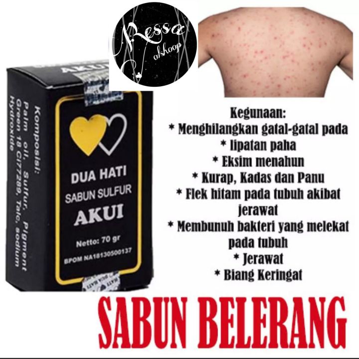 Sabun Gatal Kulit Sabun Akui Dua Hati Belerang Obat Penyakit Kulit Obat