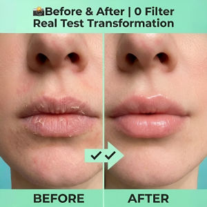 Lip Serum Gel Oil Hydrating Plumping Tinted Serum Reduces Lip Lines Long Lasting Treatment Smoothen Brightening