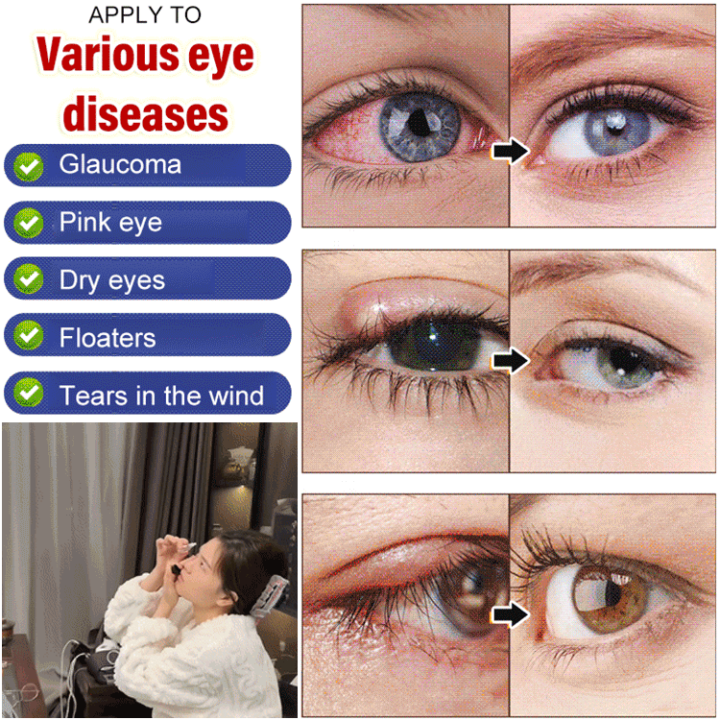 Care eye eye drops deep cleansing set Lutein nourishing eye