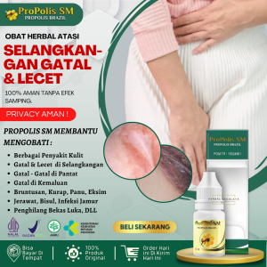 Obat Oles Selangkangan Lecet 100% Alami & Aman Obat Selangkangan Sering Gatal dan Lecet Selangkangan Lecet pada Ibu Hamil Selangkangan Gatal & Lecet Saat Hamil Ruam di Selangkangan Gatal Jamur di Selangkangan Kurap di Selangkangan - PROPOLIS SM