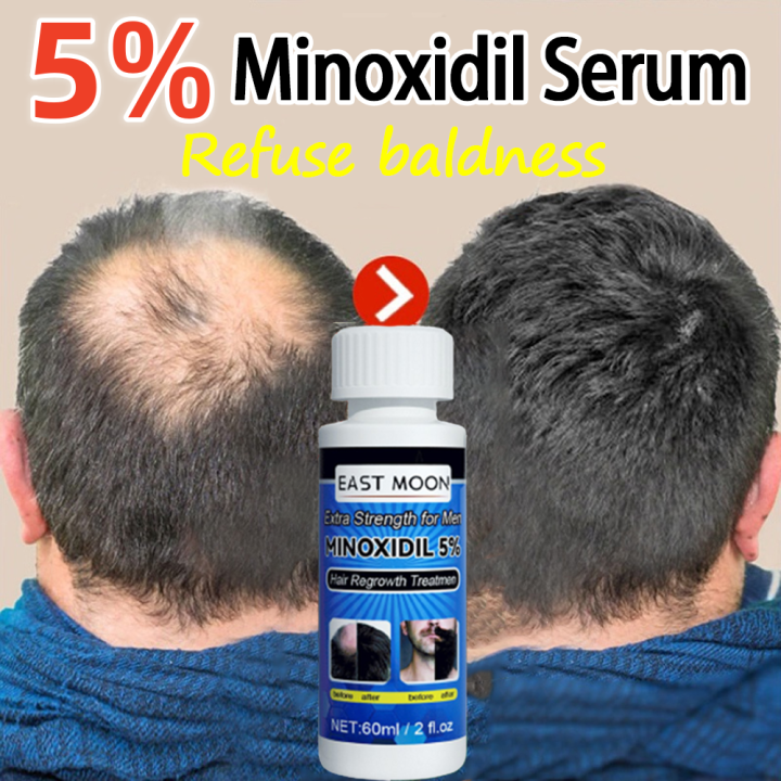 East Moon Hair Growth Serum Extra Strength Minoxidil 5% Hair Grower For ...