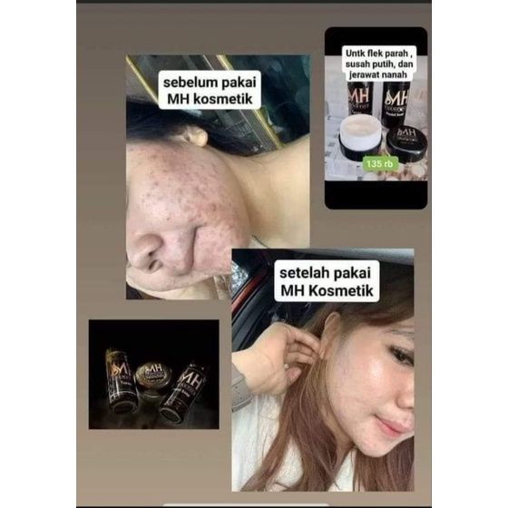 MH Kosmetik Ori BPOM Original 100 1Paket Flek Hitam Dan