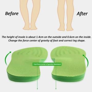 1Pair Orthopedic Arch Support Insole X/O Type Legs Valgus Feet Correction Arch Support Orthotics Shoe Pads for Shoes Adult and Kids beautiful leg adjustment