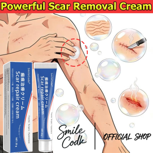 Scar Remover Cream 20g 祛疤膏 Ubat Krim Hilangkan Parut Krim Hilangkan Parut Hitam scar treatment scar gel Remove Stretch Marks Scald Burns Bite Scar