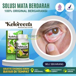 Obat Mata Berdarah Akibat Benturan Penghilang Bercak Merah Pada Mata Mata Berdarah Di Bagian Putihnya Pendarahan Di Mata Karena Terkena Benda Tumpul Cedera Di Bola Mata Memerah / Warna Kemerahan Anak Dewasa Keloreena 50 Kapsul Terjamin Original ASL