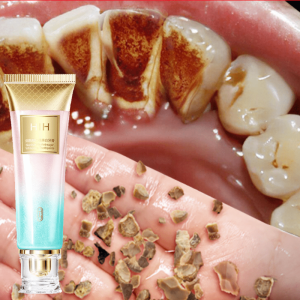 pasta gigi pemutih gigi kuning Niacinamide whitening toothpaste 100g Pembersih karang gigi odol penghilang karang gigi