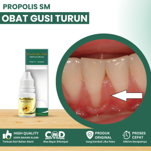 Obat Gusi Turun Obat Gusi Bengkak Sakit Obat Kumur Untuk Gusi Turun Kebawah Obat Resesi Gusi Obat Radang Gusi Untuk Gusi Turun Ke Bawah Gusi Sakit Dan Perih Dengan Propolis