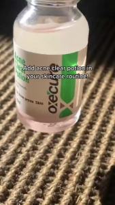 OXECURE 2% Salicylic Acid Acne Clear Potion 15ml