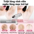 Máy triệt lông lạnh sở hữu công nghệ triệt lạnh lên đến 5 độ C, không gây nóng rát, Máy triệt lông mini tại nhà vĩnh viễn máy triệt tẩy lông lạnh laser may triet long cầm tay vùng kín bikini nách bh 2 năm. 