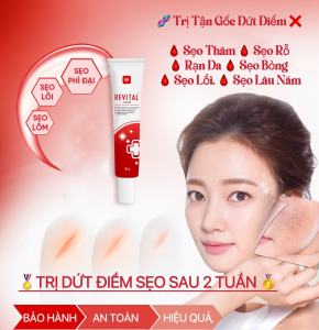 Kem Mờ Sẹo Revital 30gGiúp Làm Mờ Và Ngăn Ngừa Các Loại SẹoPhục Hồi Da Hư TổnGiúp Da Sáng MịnĐều Màu