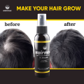 [Buy1 Take1 Today] Hairmax Hair Growth Minoxidil Serum Spray fast hair growth hair grower original. 