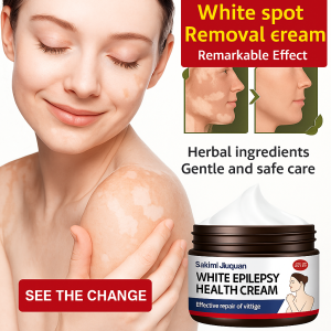 Vitiligo Specialized Health Cream Vitiligo treatment cream White Spot Eliminate Vitiligo Treatment Cream  Herbal Extract白癜风药膏