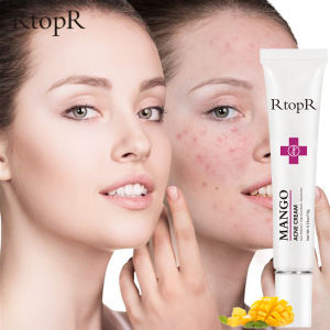 RtopR Mango Acne Treatment Cream Blackhead Repair Gel Serum Control Shrink Pores Scar Whitening Moisturizer Cosmetics Skin Care