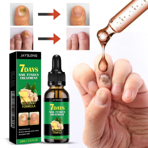 Ginger Nail Treatment 7days Nail Treatment Ginger Nail Growth Serum Ginger Cuticle Care Oil for NailsCuticle Serum for Nails Anti-infective Nourishing Brighten Foot Nail Oil 50ML
