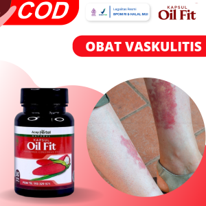 Obat Vaskulitis Obat Radang Pembuluh Darah Radang Pembuluh Darah Pecah Obat Kulit Ruam Merah Obat Purpura Vaskulitis Obat Bintik Merah Dengan OilFit