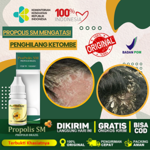 Obat Penghilang Ketombe Parah Berkerak Anti Ketombe Basah Penghilang Ketombe Menahun - ProPolis SM