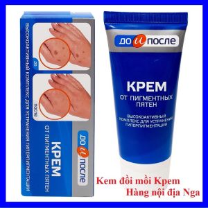 Kem đồi mồi Nga Kem Kpem 50ML Kem dưỡng da tay chân mờ đồi mồi hết thâm sạm nám tàn nhang