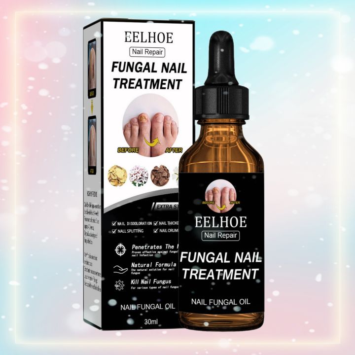 【Malaysia Ready Stock】Fungal Nail Repair Essence Serum anti fungal nail
