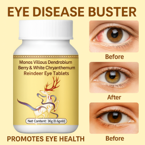 Eye Strain Relief Vision Support Supplement with Dendrobium Goji Berry Chrysanthemum Deer Eye Extract Natural Eye Health Tablets