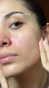 Peel tẩy da chết DR.MELAXIN PEEL SHOT 80ml