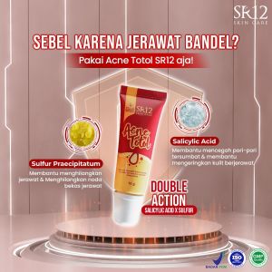 Acne Totol Tube SR12 Membantu Mengatasi Masalah Jerawat di wajah