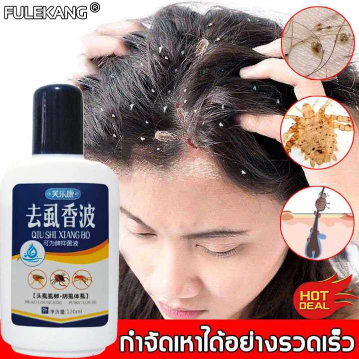 ยาฆ่าเหา 120ml แชมพูกำจัดเหา แม่เหา ลูกเหา ปลอดภัยไม่ระคายเคือง แชมพูฆ่าเหา ไข่เหาสำหรับเด็ก