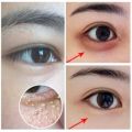 【COD】Eye cream remove repair fat particles eye wrinkles bags under the eyes dilute dark circles 20g. 