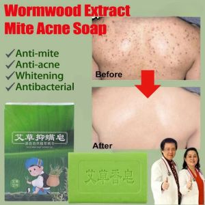 Wormwood Mite Acne Soap Eczema Skin Repair Acne Psoriasis Seborrhea Itching Anti Fungus Bath Whitening Sulfur Soap 80g Remove Mites Acne Shrinks Pores Facial Oil Control Lightens Skin Pigmentations Skin Antibacterial Bar Soap