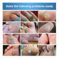 24pcs Warts Remover Foot Corn Pads removal pain patch Calluses health foot care first aid. 