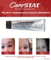 Carestat Silver Wound Dressing Gel 1oz and 3oz. 