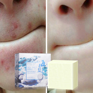 100g sea salt soap shrinks pores whitens and removes blackheads Addition to Mites 100% authentic  mite removal soap Acne & Oil Control Soap for Face & Body 除螨控油皂洗臉手工皂