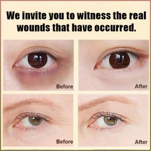 Eye Mask Patch Mild Bright Resurfacing Restoration Soft and Moist Soften Skin Reduce Eye Wrinkles