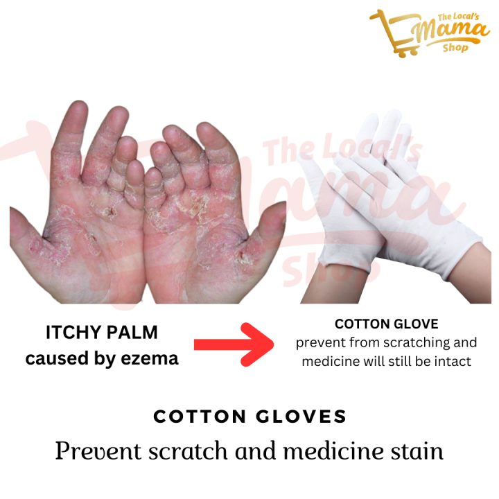 SG High Quality White Thin Cotton Eczema Glove for Eczema Dry and Itchy