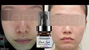 Jemeesen Freckles Whitening Cream Effective Remove Melasma/Dark Spot Pigmentation Remove Cream Anti Aging Moisturizing