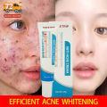 ointment Remover acne pimples Cream Fades Acne Marks Repairs Acne Pits Facial Scar Care remove pimples and dark spots Aloe Gelatine Pimple Eraser Acne Treatment Cream Acne Scar Remover Acne Repair Cream for face whitening cream. 