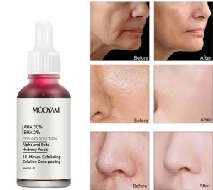 [MOOYAM] PEELING SOLUTION AHA 30% + BHA 2% - MENCERAHKAN MENGENCANGKAN SERTA MENYAMARKAN BEKAS JERAWAT KERUTAN & PORI BESAR 30ml