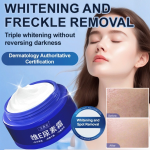 💕Brighten and Lighten Spots💕Blemish-Lightening Urea Cream Whitening Cream Lightens Spots and Brightens Skin Tone Moisturizing Natural Cream Anti-Aging Essence Cream