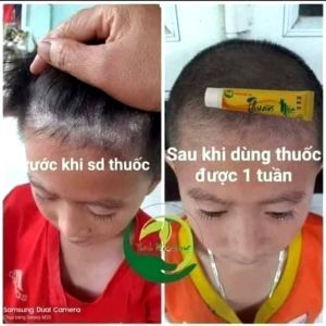 COMBO 5 KEM BÔI DA THUẦN MỘC  THANH MỘC HƯƠNG