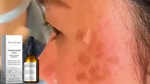 【Ready Stock】West Month Tranexamic Acid Brightening Essence – Fades Dark Spots & Uneven Skin Tone Deep Hydration with Hyaluronic Acid Soothes & Restores Radiance 30ml