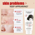 Kojic Acid Facial Wash Sabun Cuci Muka Asam Kojic 120g Deep Cleansing Oil Control Anti-Ance Deep Cleansing Oil Control Anti-Ance Pembersih Wajah Mencerahkan Melembabkan Menutrisi Kulit Anti Acne Freckle Remover Facial Wash Pembersih Pemutih Kulit Wajah. 