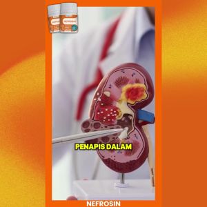 Furamed Nefrosin - Formulasi Herba Untuk Kesihatan Buah Pinggang dan Pesakit CKD.Mild and effective