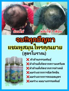 แชมพูลดผมร่วง แชมพูสมุนไพรคุณยาย ผมบาง ผมร่วง หัวไม่ล้าน