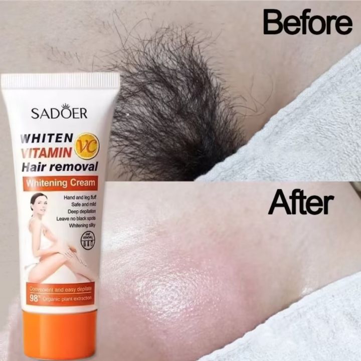 big sale Fast Hair Removal Cream Permanent for underarm hair