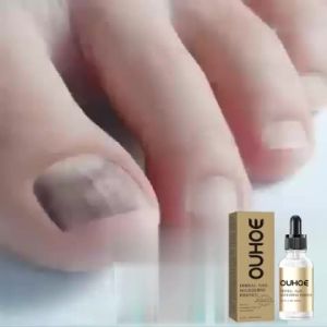 Ouhoe Nail Care Essential Oil Hand and Foot Moisturizing Care Thickened Nail Gray Nail Inlay Essential Oil